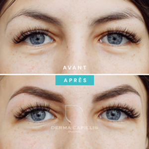 Résultat sourcils maquillage permanent avant et après