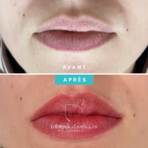 Résultat bouche maquillage permanent avant et après