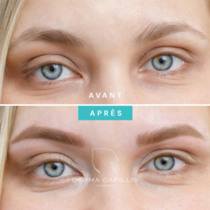Résultat sourcils maquillage permanent avant et après