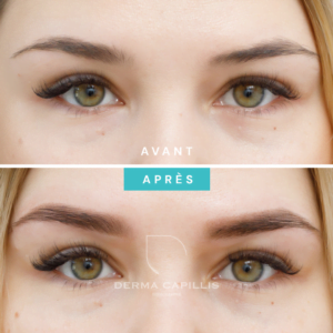 Résultat sourcils maquillage permanent avant et après